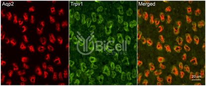 Trpv1 Antibody
