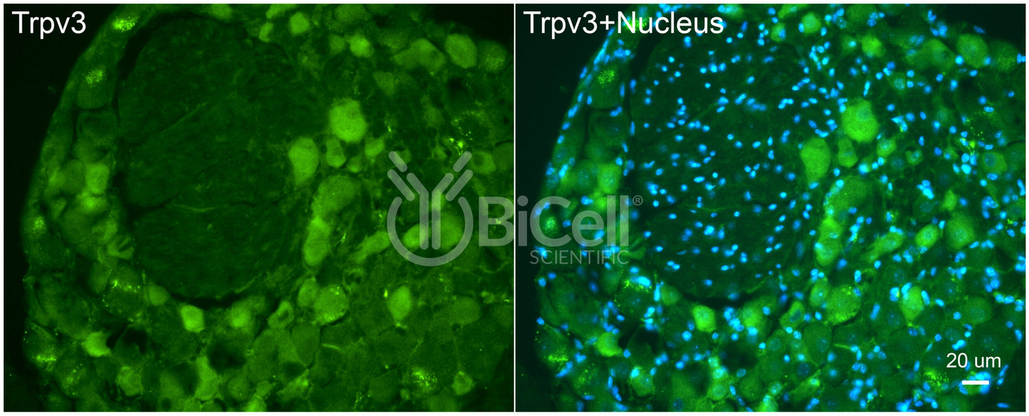 Trpv3 Antibody - FFPE Validated