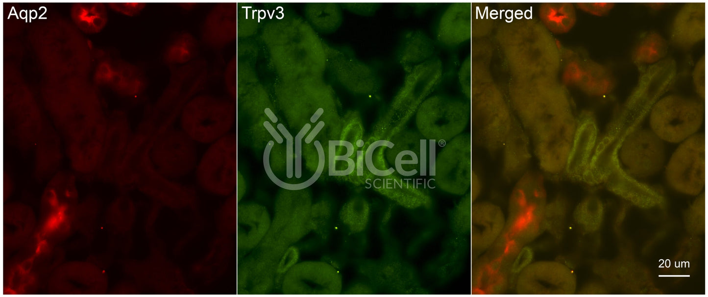 Trpv3 Antibody - Western Blot Validated