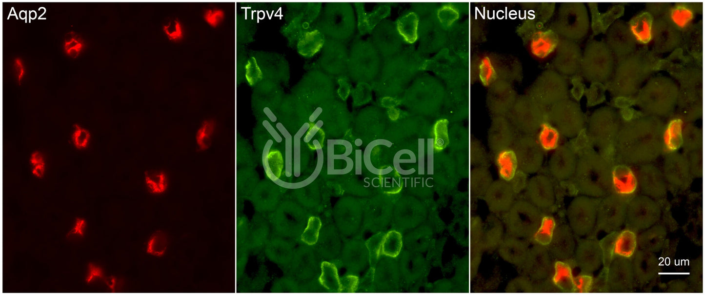 Trpv4 Antibody - FFPE Validated