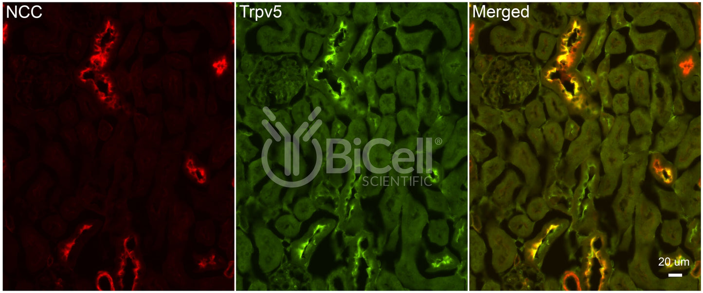 Trpv5 Antibody