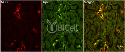 Trpv5 Antibody