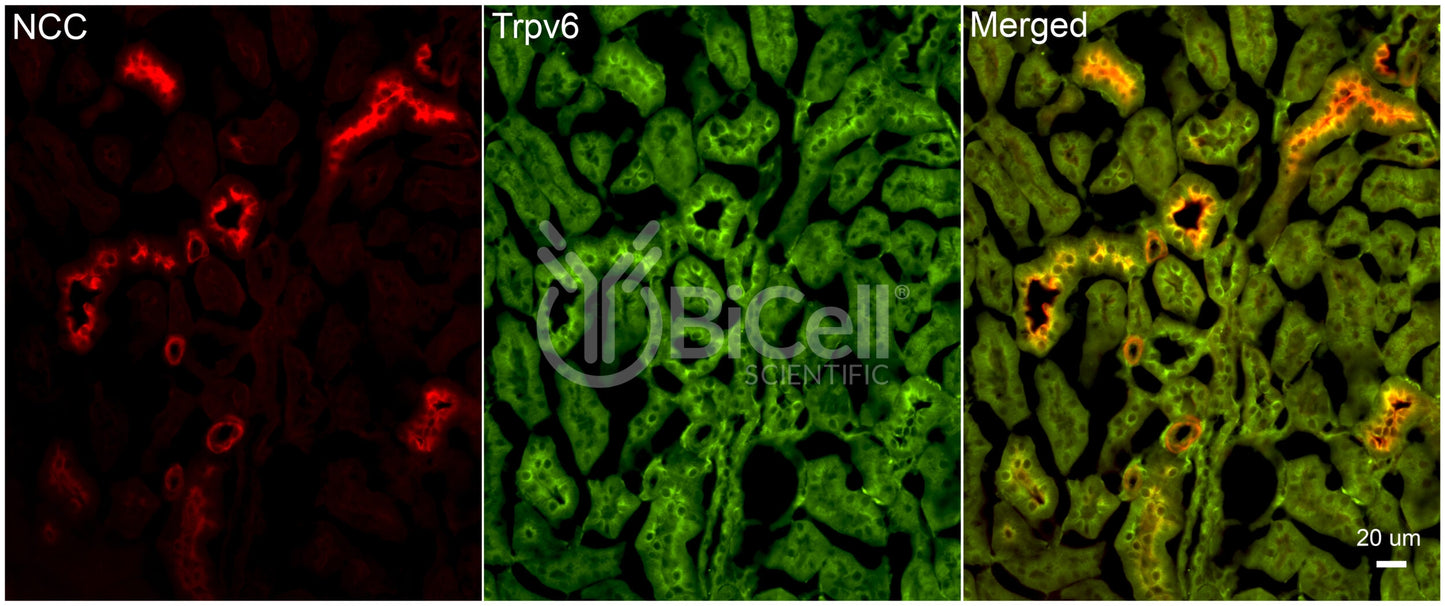 Trpv6 Antibody - Western Blot Validated