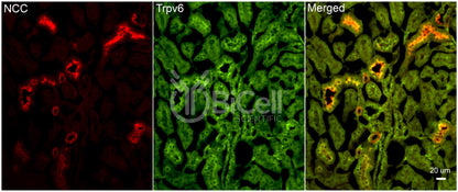 Trpv6 Antibody - Western Blot Validated