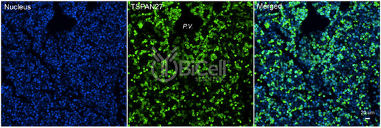 Tetraspanin-27 (TSPAN27 or CD82 or KAI1) Antibody - FFPE Validated