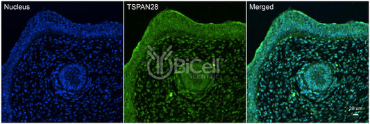 Tetraspanin-28 (TSPAN28 or CD81) Antibody - Western Blot Validated