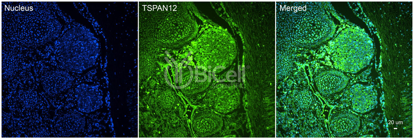 Tetraspanin-12 (TSPAN12) Antibody - Western Blot Validated
