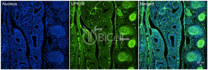 Tetraspanin-20 (TSPAN20 or Uroplakin-1b or UPK1B or UPK1) Antibody - FFPE Validated