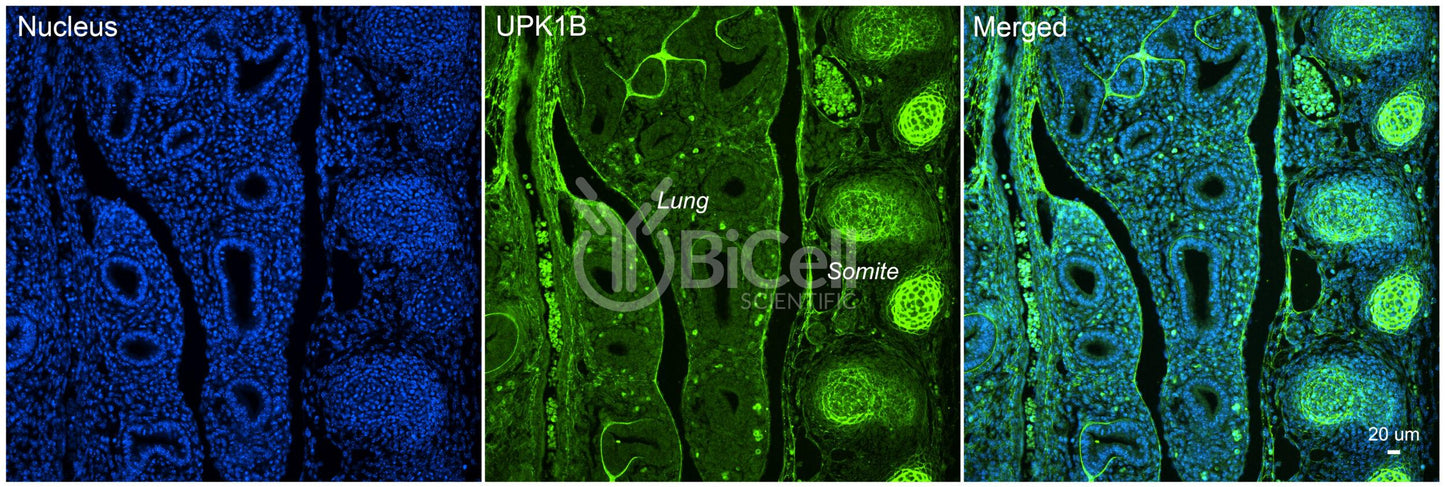 Tetraspanin-20 (TSPAN20 or Uroplakin-1b or UPK1B or UPK1) Antibody
