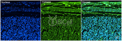 Tetraspanin-9 (TSPAN9) Antibody