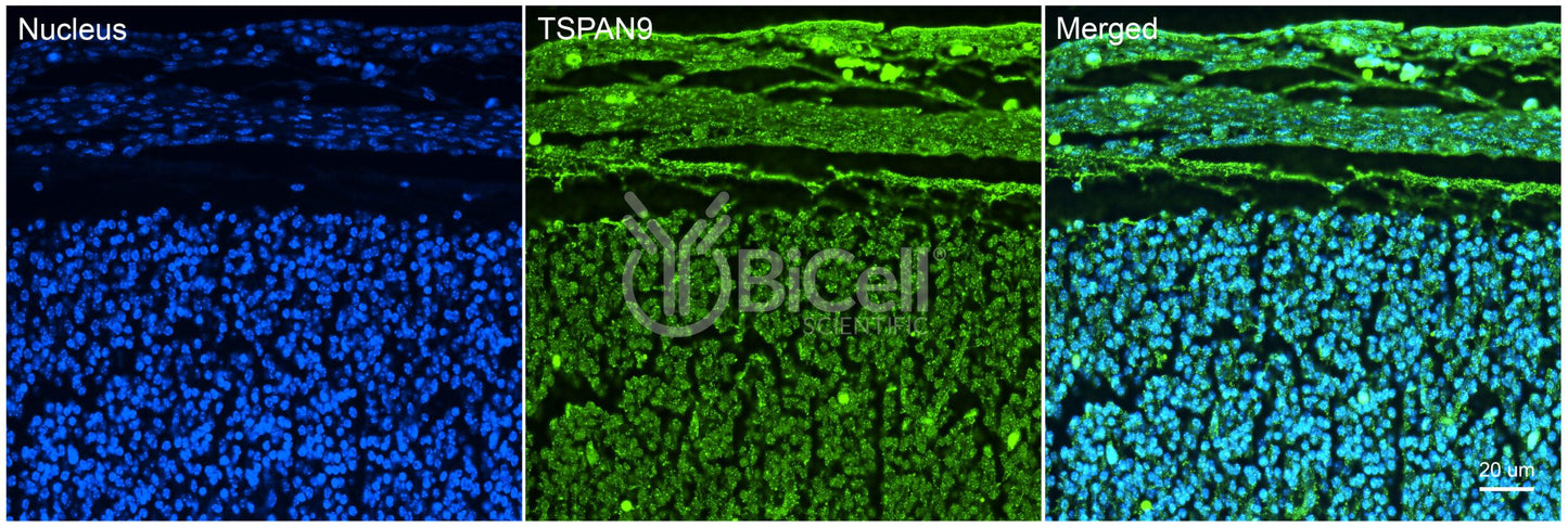 Tetraspanin-9 (TSPAN9) Antibody - FFPE Validated