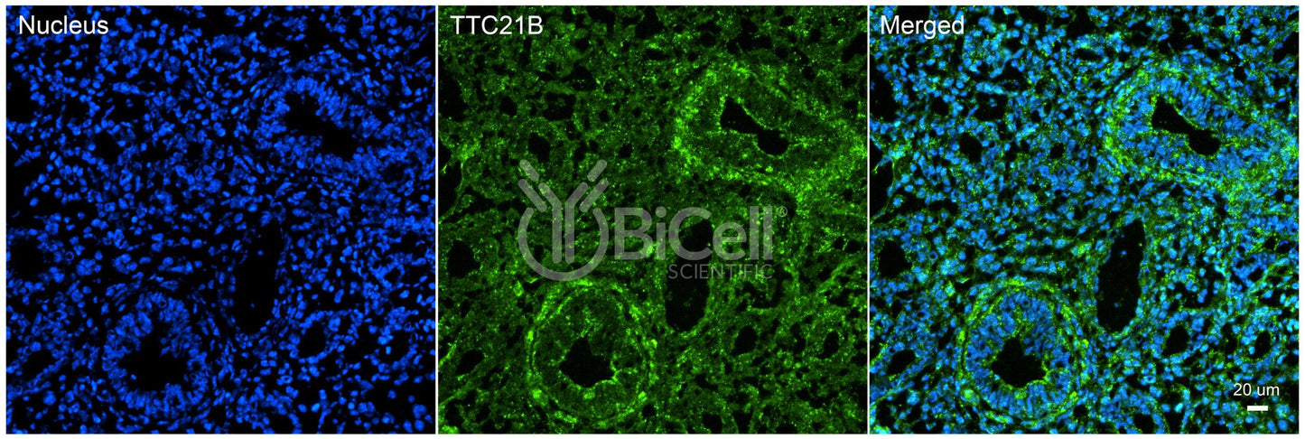 TTC21B (IFT139 or NPHP12) Antibody