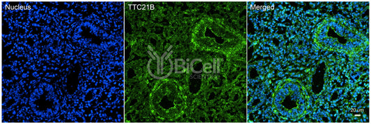 TTC21B (IFT139 or NPHP12) Antibody - FFPE Validated