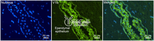 AVPR1b Antibody - Western Blot Validated