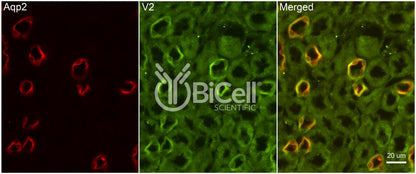 AVPR2 Antibody