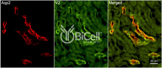 AVPR2 Antibody
