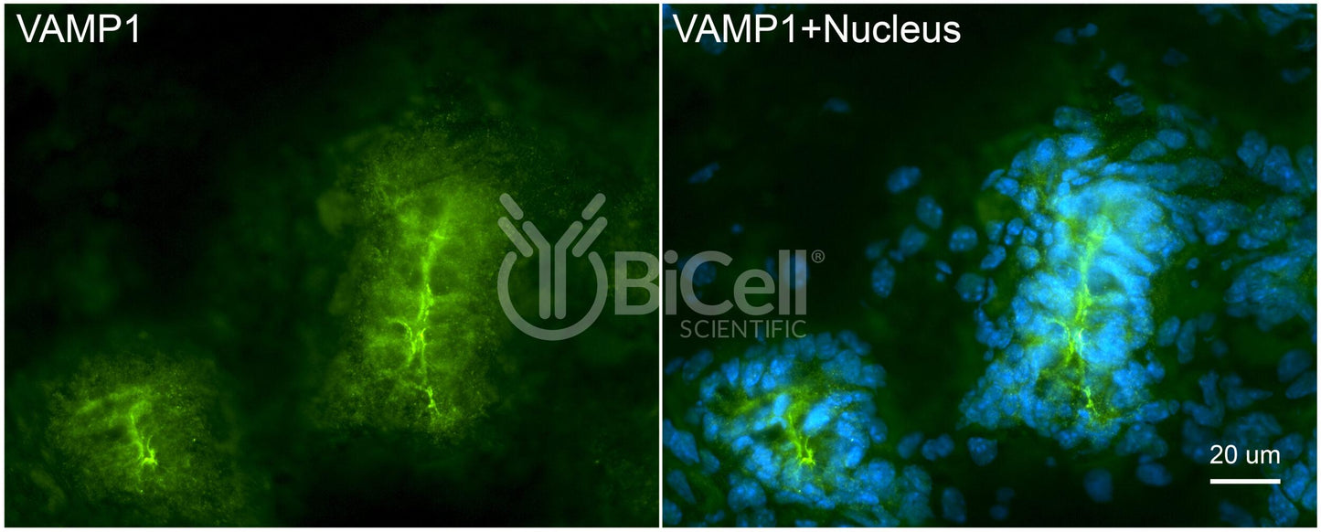 VAMP1 (SYB1) HiRe Antibody