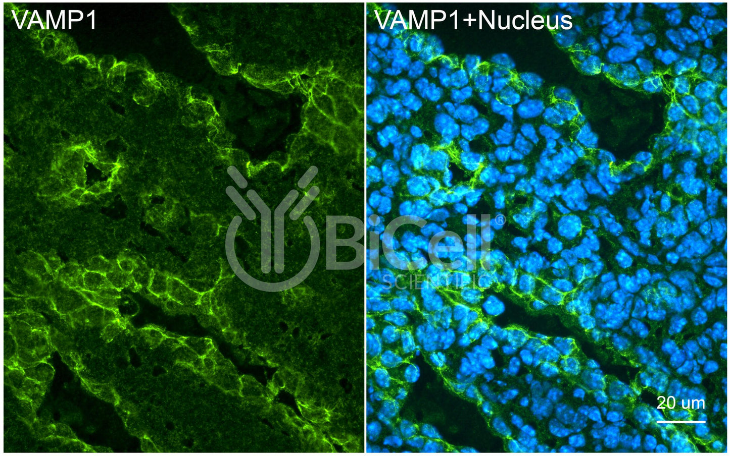 VAMP1 (SYB1) HiRe Antibody - Western Blot Validated