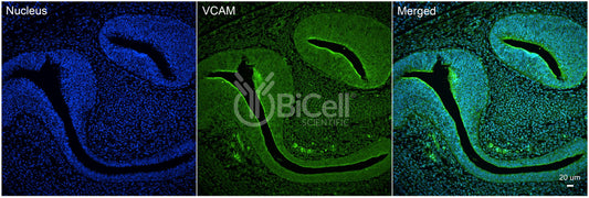 VCAM1 (CD106) Antibody - FFPE Validated