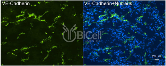 VE-cadherin (Cdh5 or Cadherin-5 or CD144) Antibody - Western Blot Validated