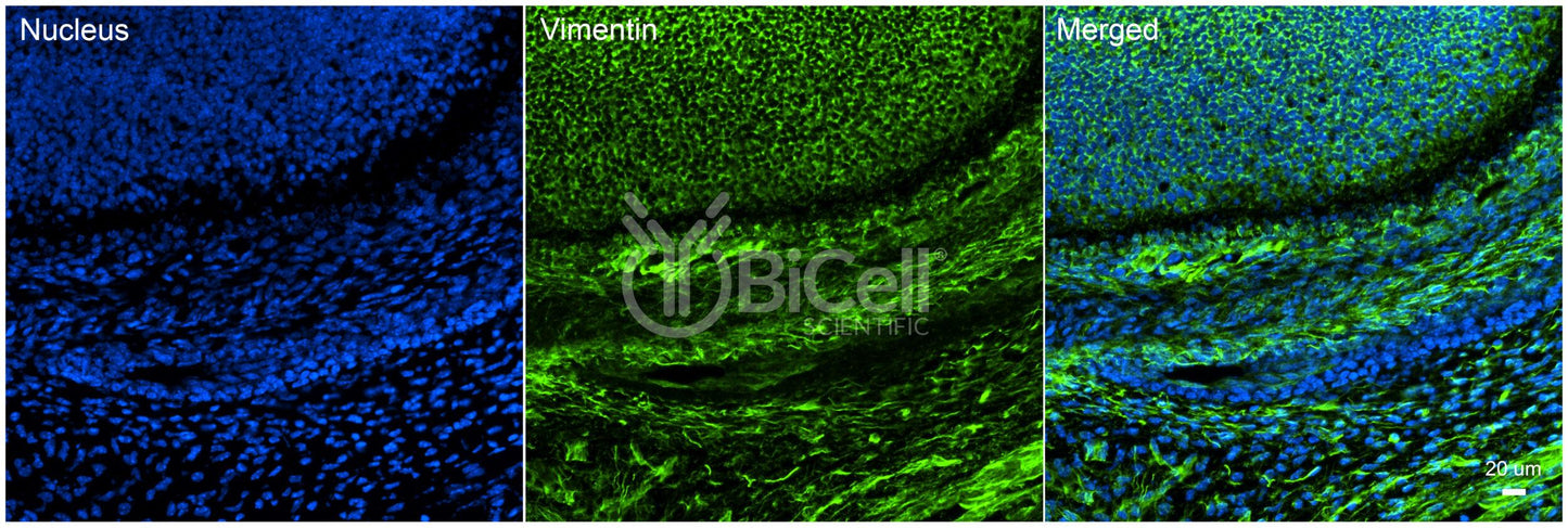 Vimentin (VIM) Antibody - FFPE Validated