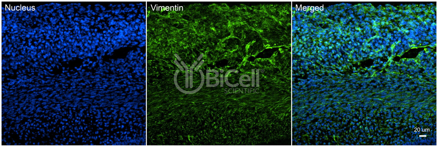 Vimentin (VIM) Antibody