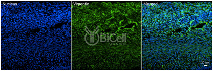 Vimentin (VIM) Antibody - FFPE Validated