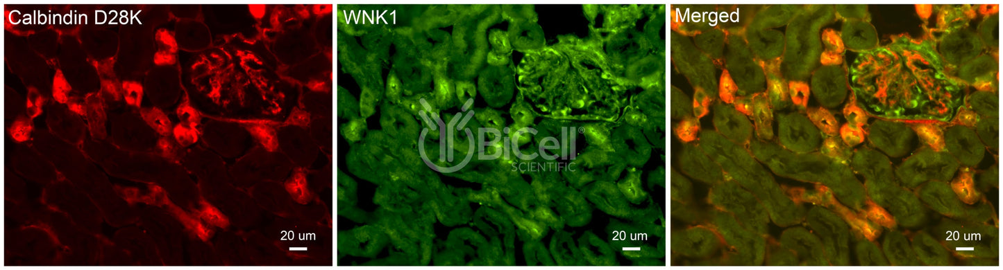 WNK1 Antibody