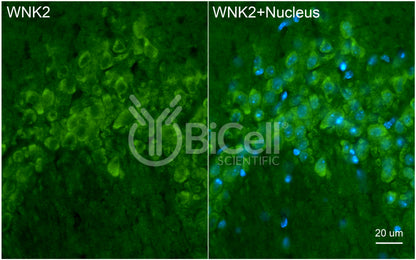 WNK2 Antibody