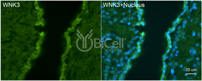 WNK3 Antibody - FFPE Validated