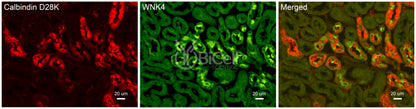 WNK4 Antibody - FFPE Validated