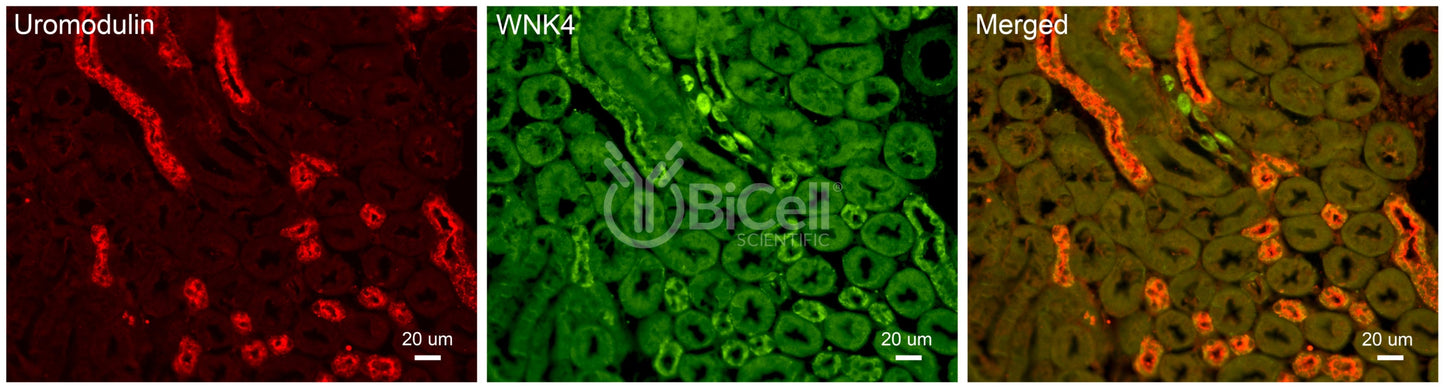 WNK4 Antibody - FFPE Validated