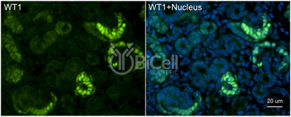 WT1 Antibody - FFPE Validated