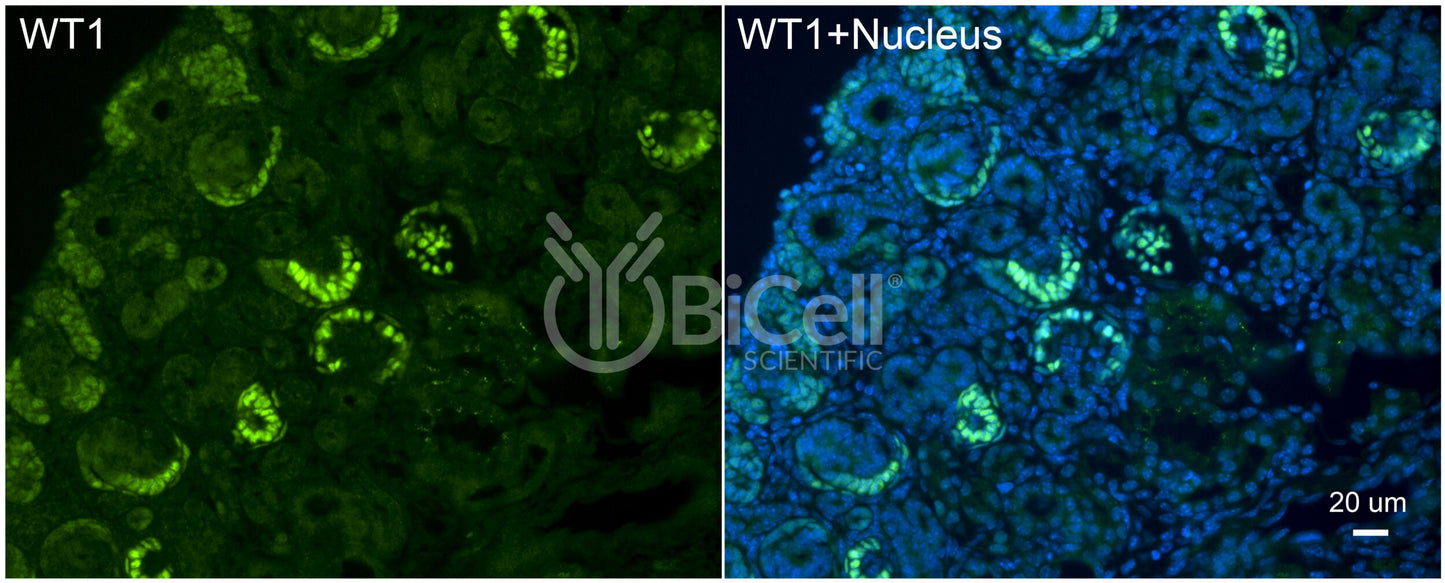 WT1 Antibody - Western Blot Validated