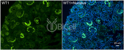 WT1 Antibody - Western Blot Validated