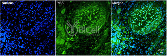 YES (YES1) Antibody - Western Blot Validated