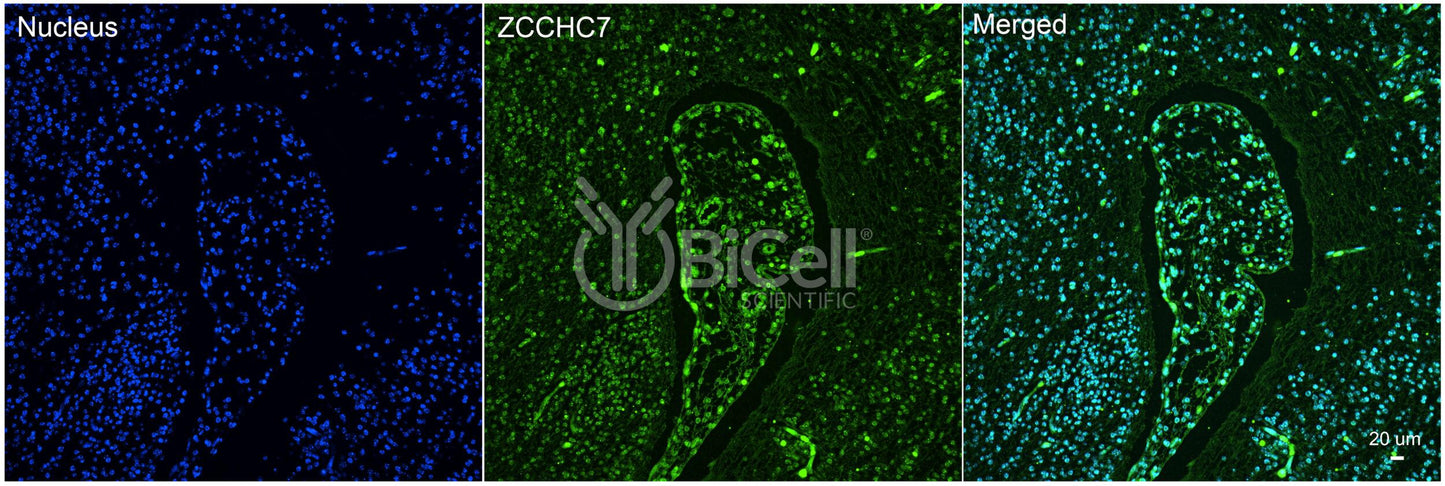 ZCCHC7 Antibody